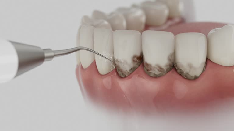 Trusted Teeth Cleaning And Checkup service in Ball Ground, GA - Dentist Open Now
